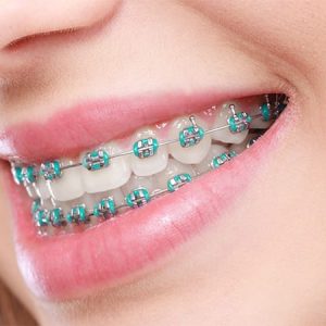 Orthodontic Care
